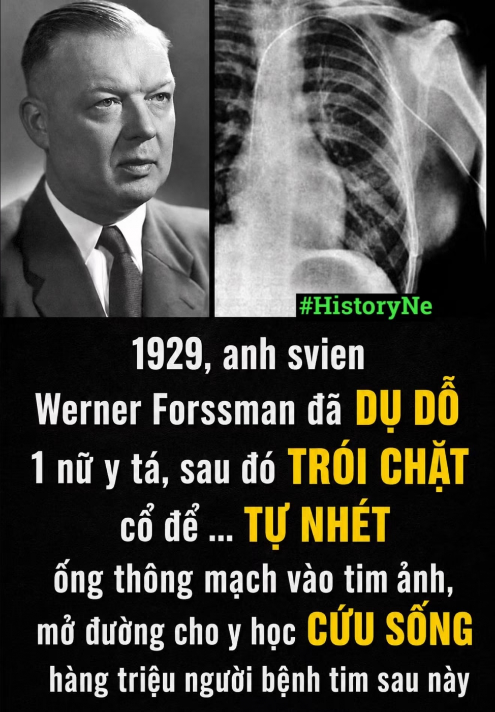 giải thưởng Nobel, Werner Forssmann 